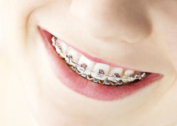 ทันตแพทย์เฉพาะทางจัดฟัน