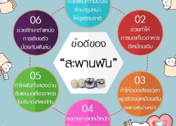ข้อดีของสะพานฟัน