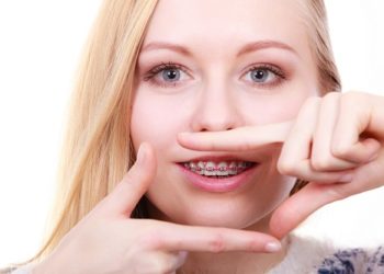 ฟันแบบไหนที่ต้องจัดฟัน