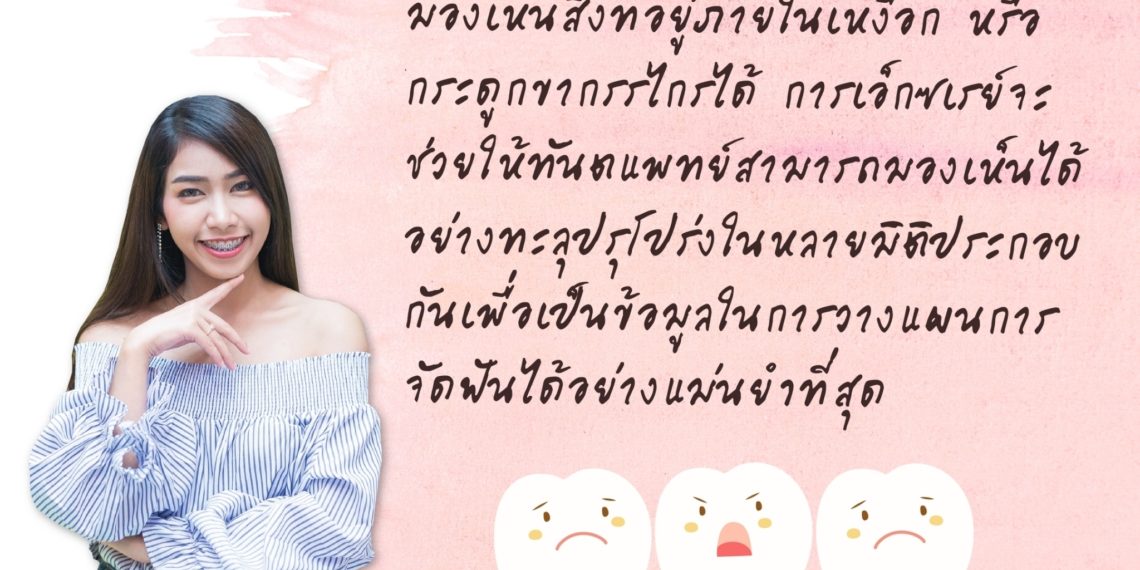 ทำไมต้องเอกซเรย์ ก่อนการจัดฟัน