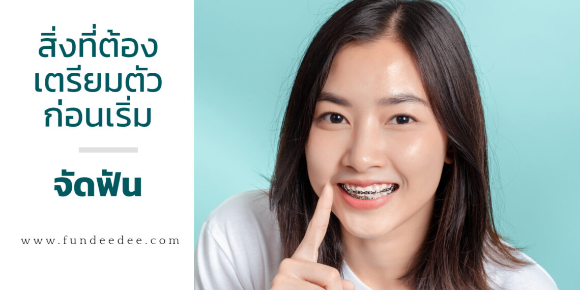 สิ่งที่ต้องเตรียมตัวก่อนเริ่มจัดฟัน